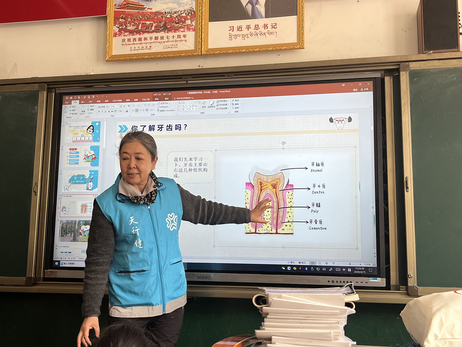 11.侨爱心工程 暖暖高原情 口腔保健项目 (3)